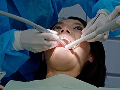 Dental İmplant