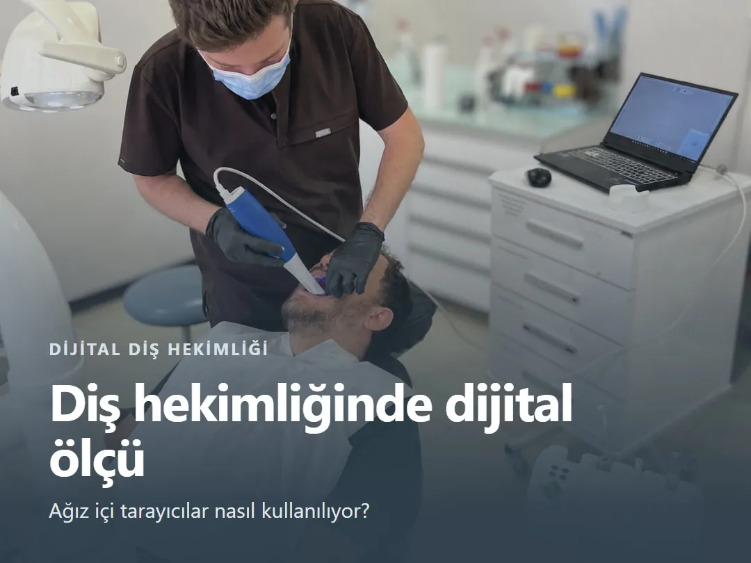Dijital diş hekimliği paylaşımı: ağız içi tarayıcıyla ölçü alınırken taranan görüntü bilgisayara aktarılıyor